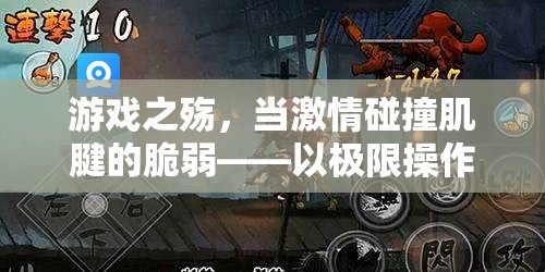 游戲之殤，激情與肌腱的脆弱——極限操作下的虛擬競技場