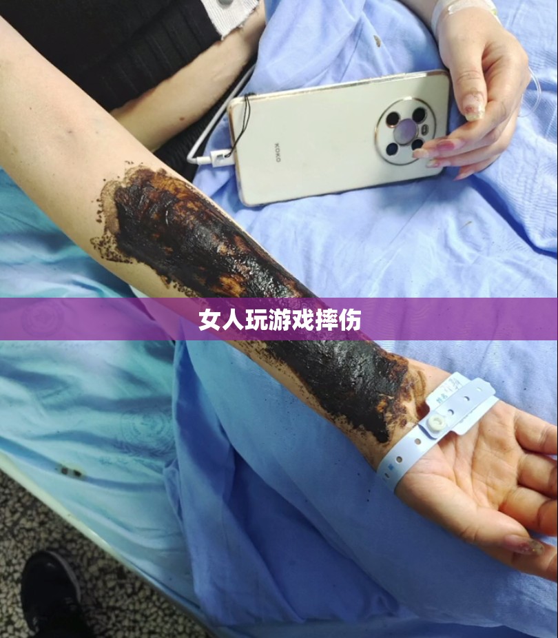 女性游戲愛好者摔傷事件引關(guān)注