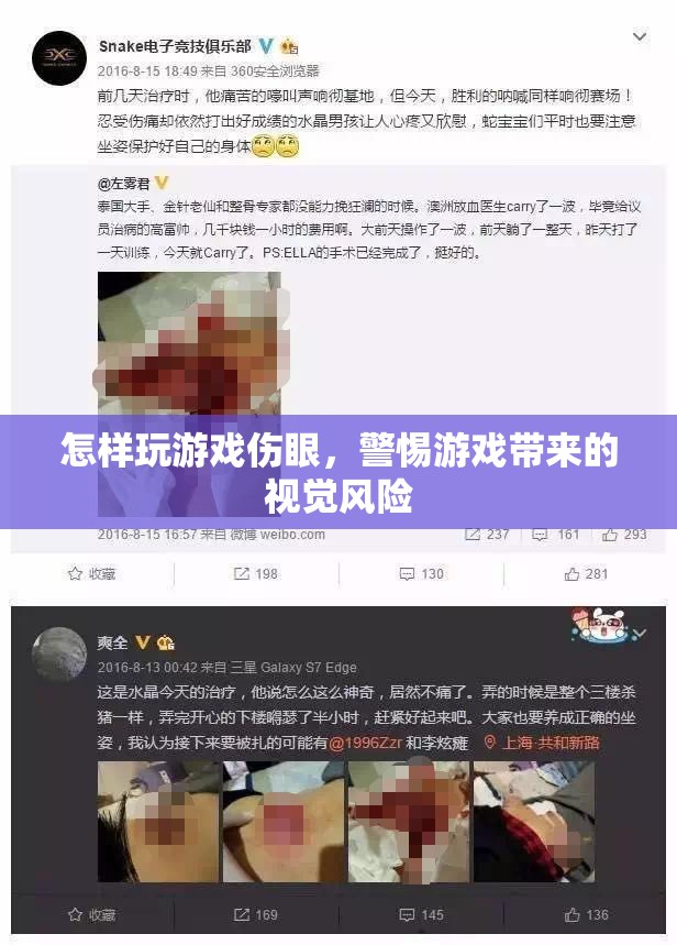 游戲傷眼，警惕視覺風(fēng)險(xiǎn)