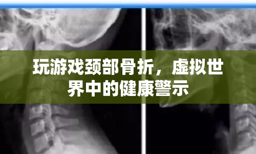 虛擬世界中的健康警示，玩游戲致頸部骨折