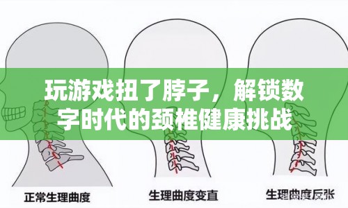 數(shù)字時代下的頸椎健康挑戰(zhàn)，玩游戲不慎扭了脖子